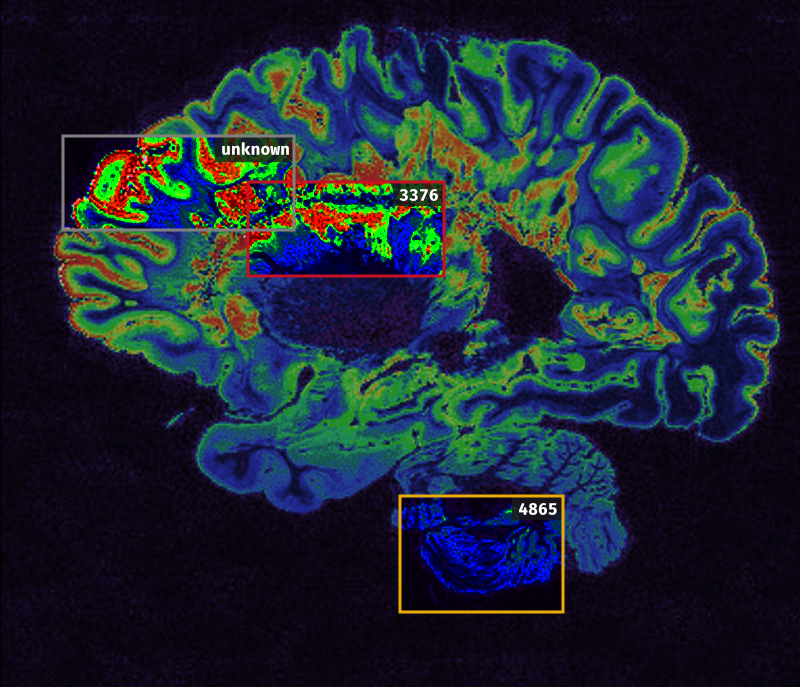 Brain.png