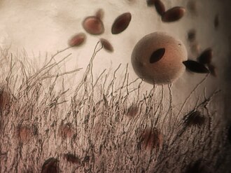 330px-Bacteria_yeast_and_fungi_02.jpg