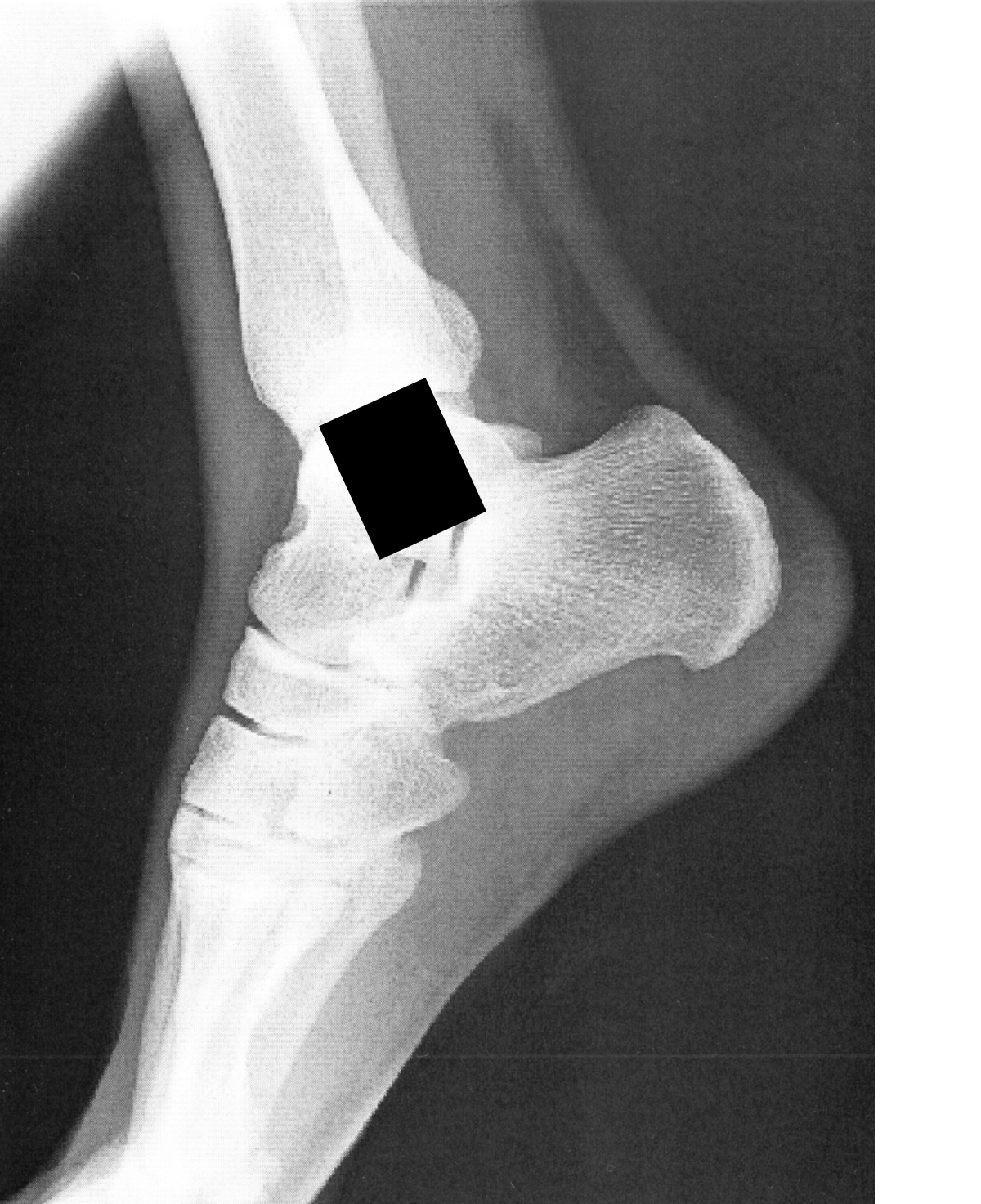 foot.png