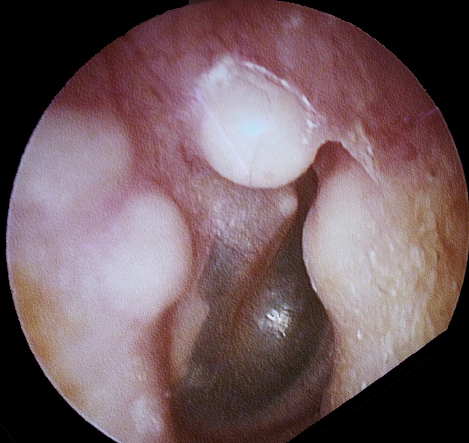 Earg.jpg