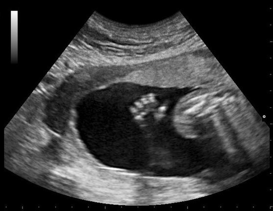 pregnancy.jpg