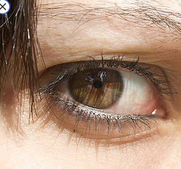 eye11.png