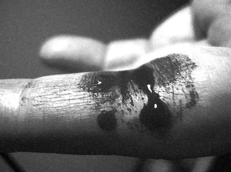 Bleeding_finger.jpg