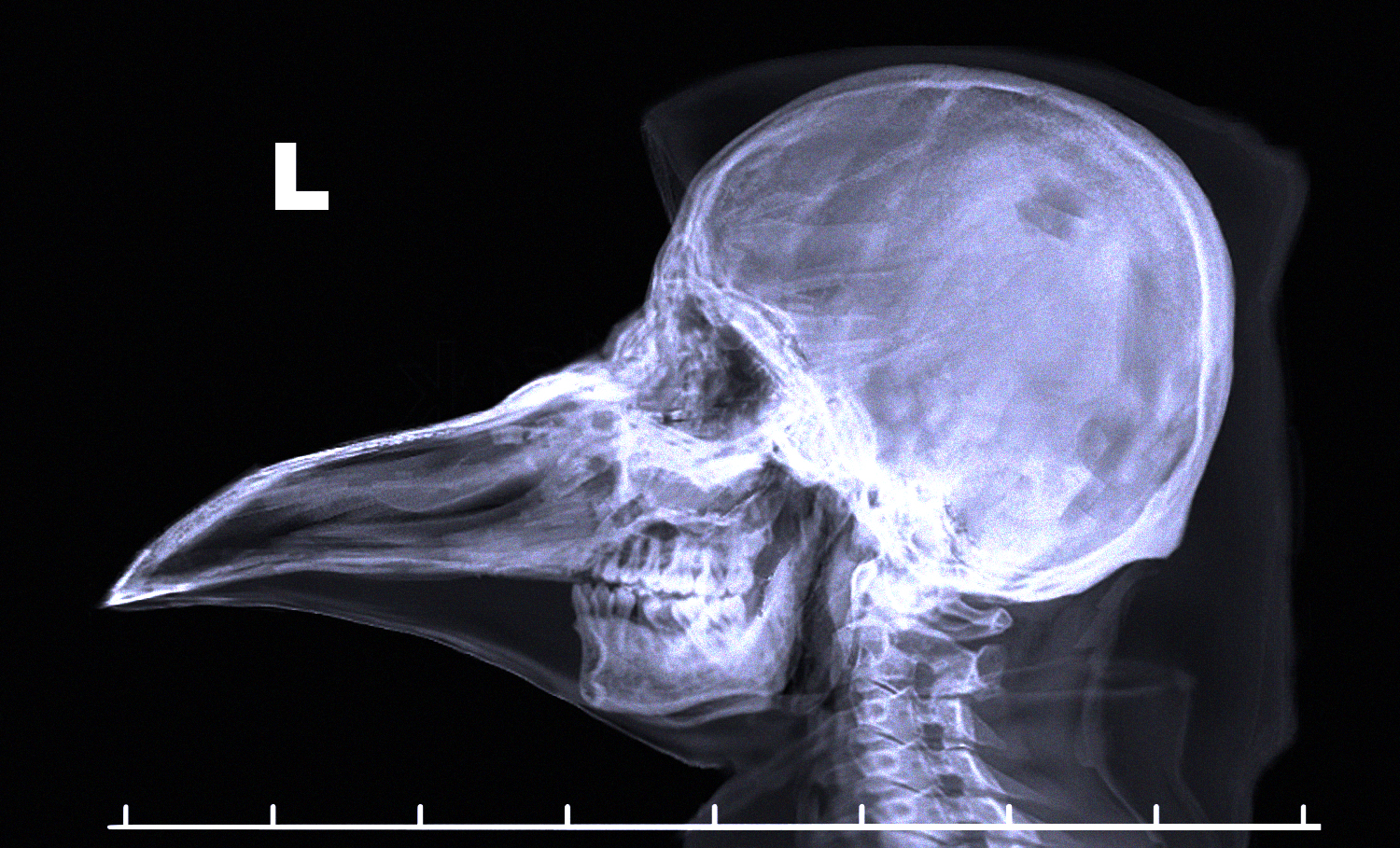 SCP049Radiography.jpg