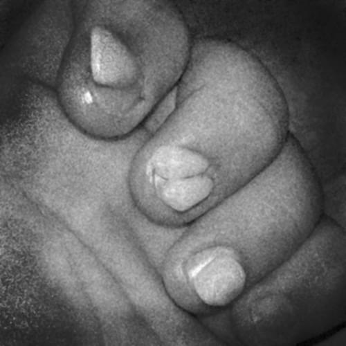 toothhand2.jpg