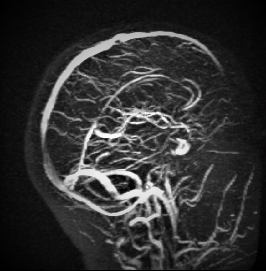 brain1.jpg