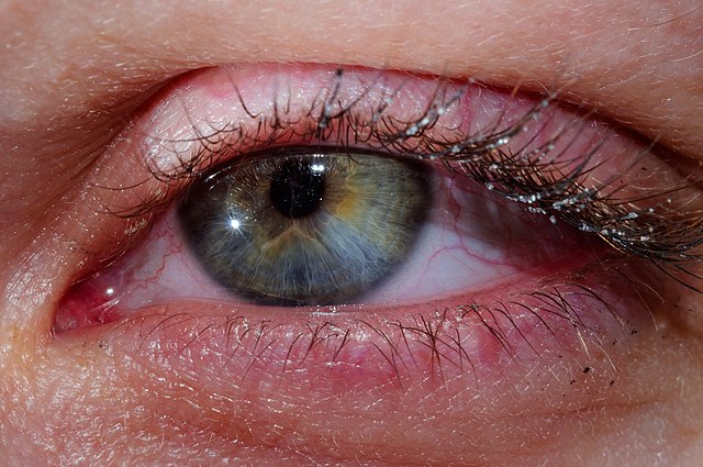 eye5.jpg