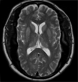 mri.png
