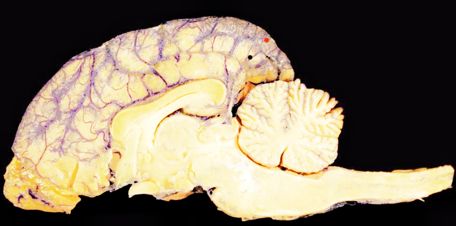 brainscp.jpg