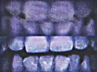 teeth.jpg
