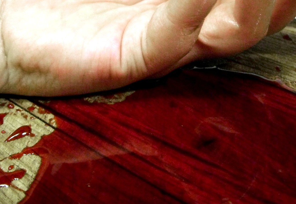 bloody hand.jpg