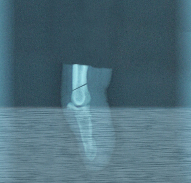 xray.jpg