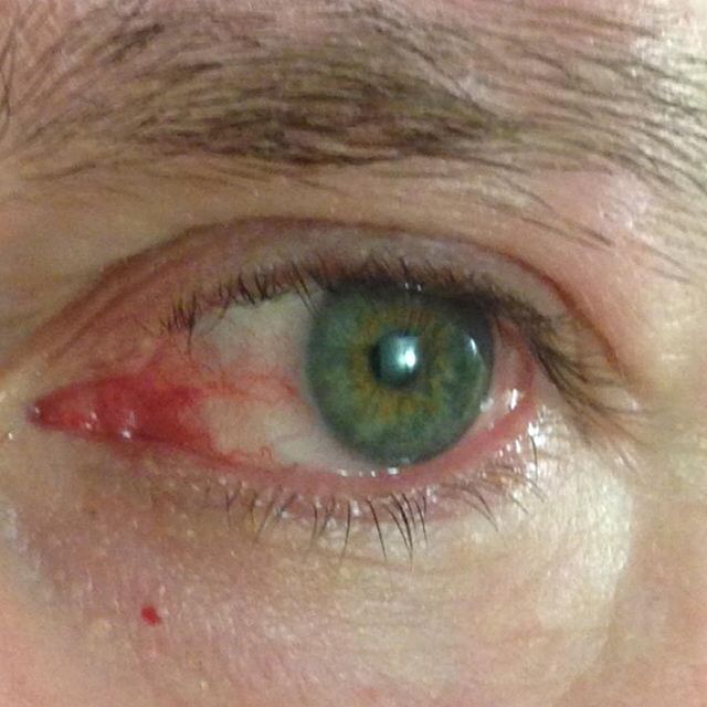 eye2.jpg
