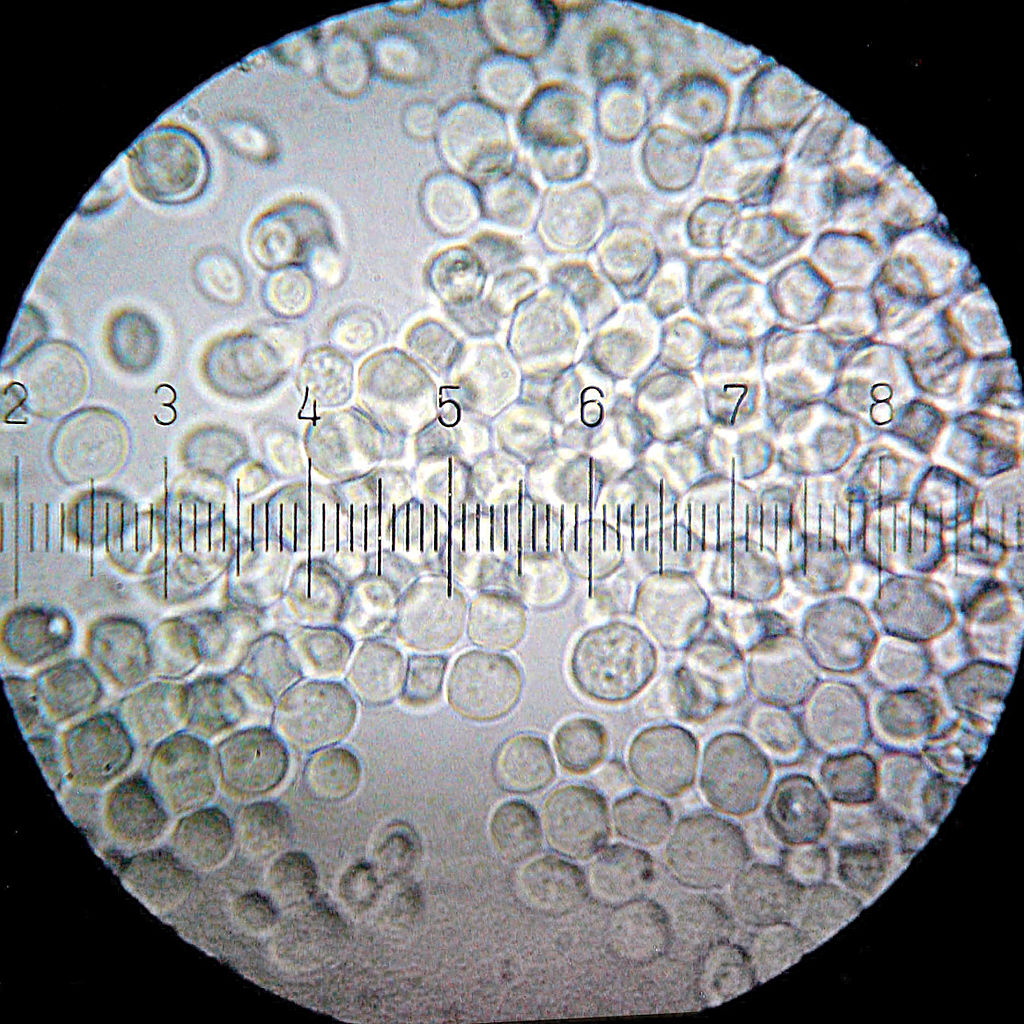 20100911_232323_Yeast_Live.jpg