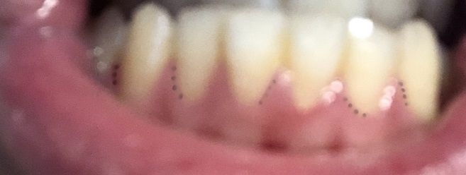 tooth2.JPG