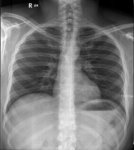 Xray.jpg