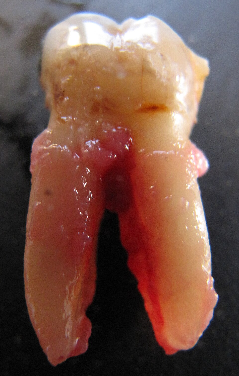 tooth.jpg