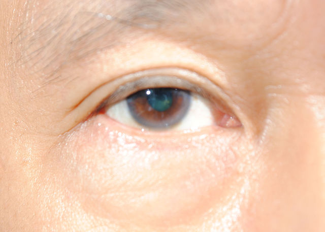 eye6.jpg