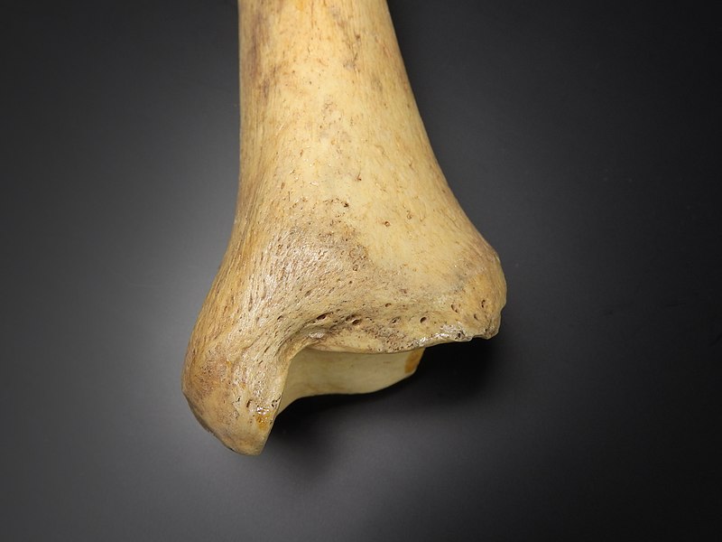 800px-Tibia_-_malleolus_medialis.jpg
