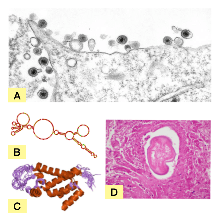 kitei-disease-1