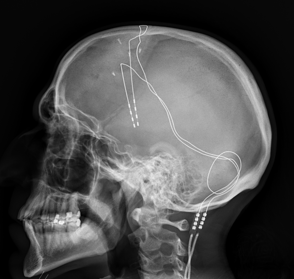 Brain.png